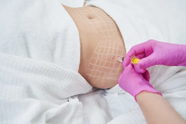 image of fat dissolving injections on love handles to help combat weight gain Swanage
