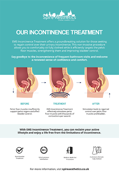 image of how urge incontinence Swanage treatment works