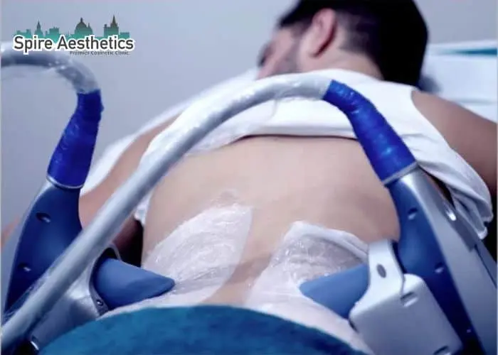 Man having fat freezing treatment done on love handles before a competitions Swanage to create a sculpted look.